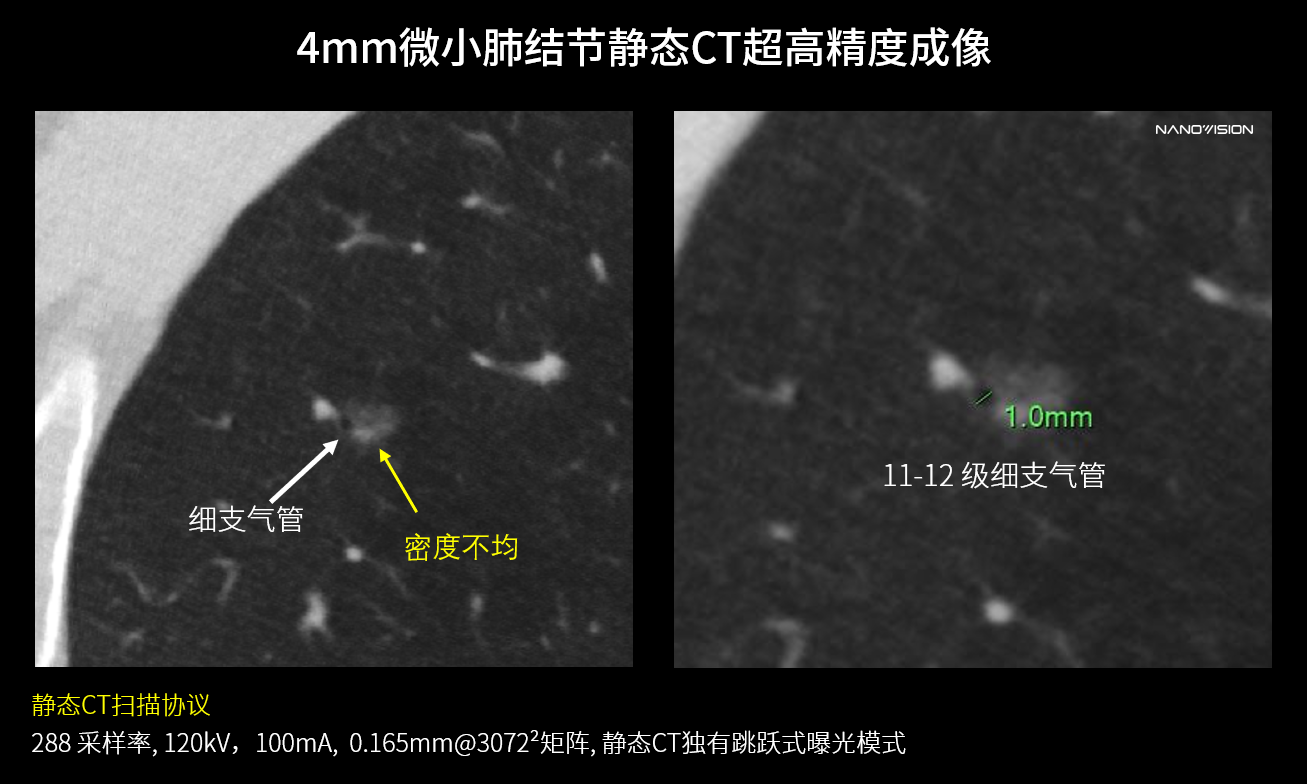 久久久www成人免费无遮挡大片